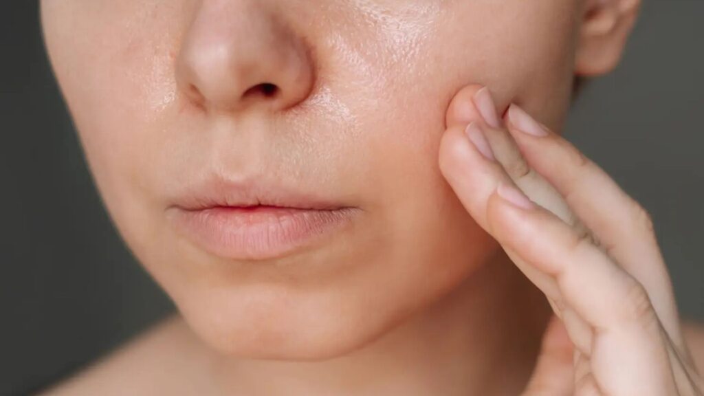 oily skin - dr anne
