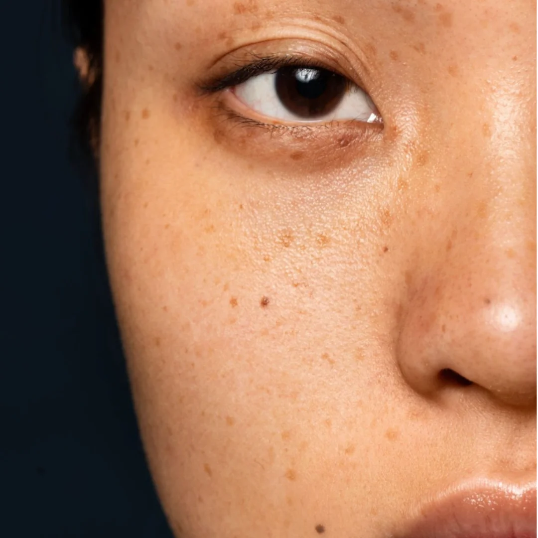 Dark Spots Protection UV Care