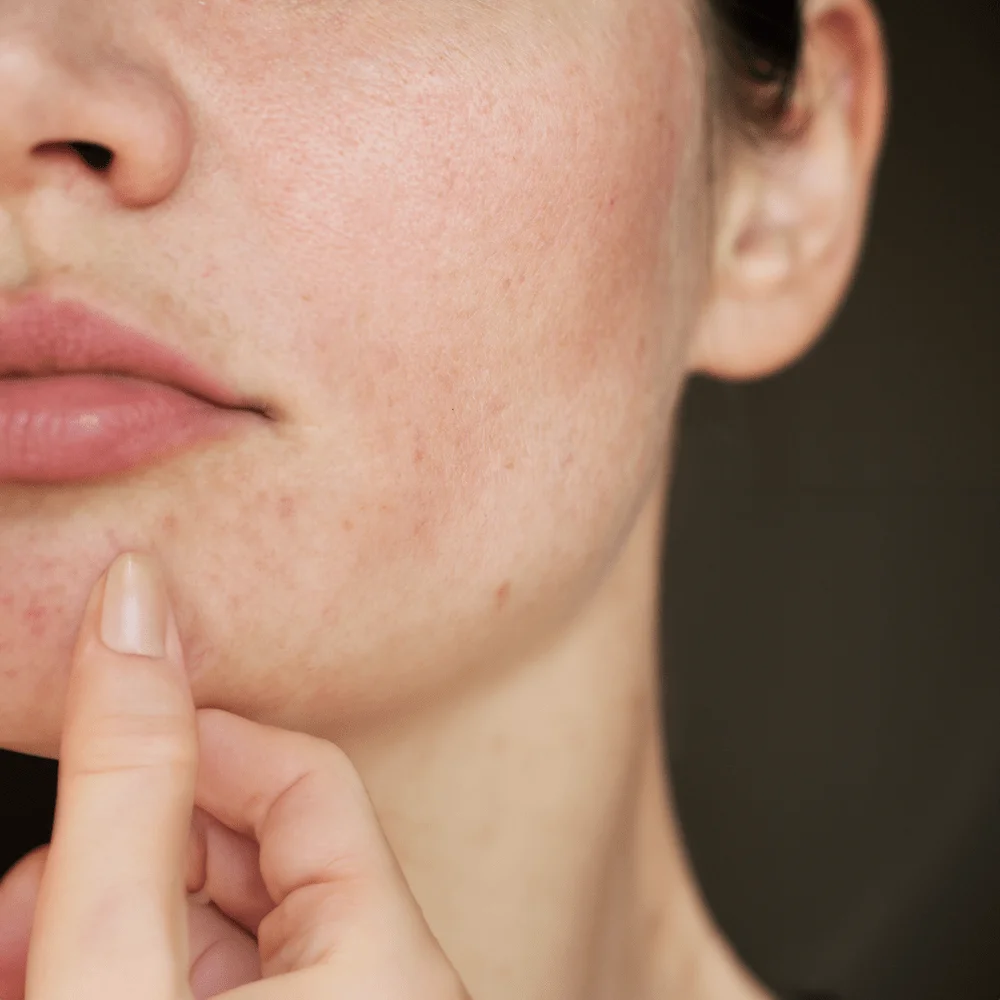 Dull Skin Treatment Analysis