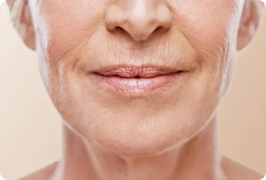 Fine Lines Treatment Profile